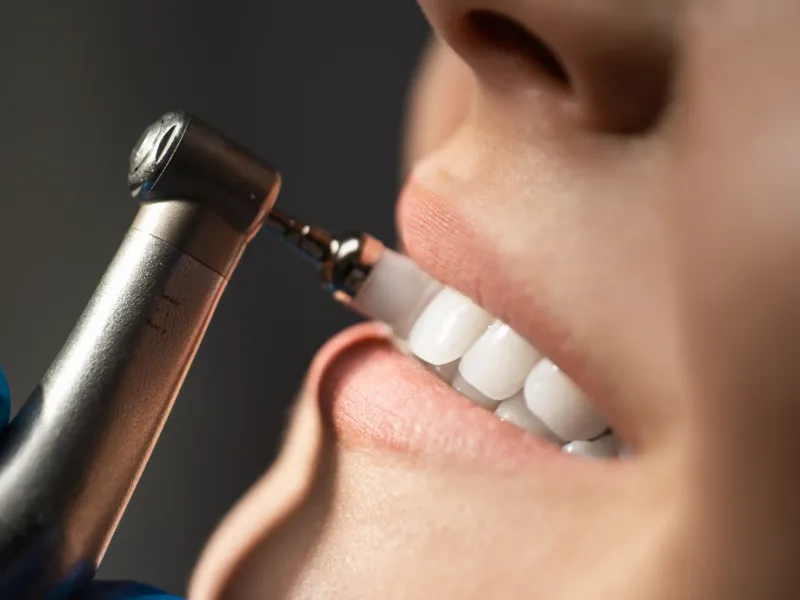Checkups & Cleanings at 3D Dental in Mastic, NY