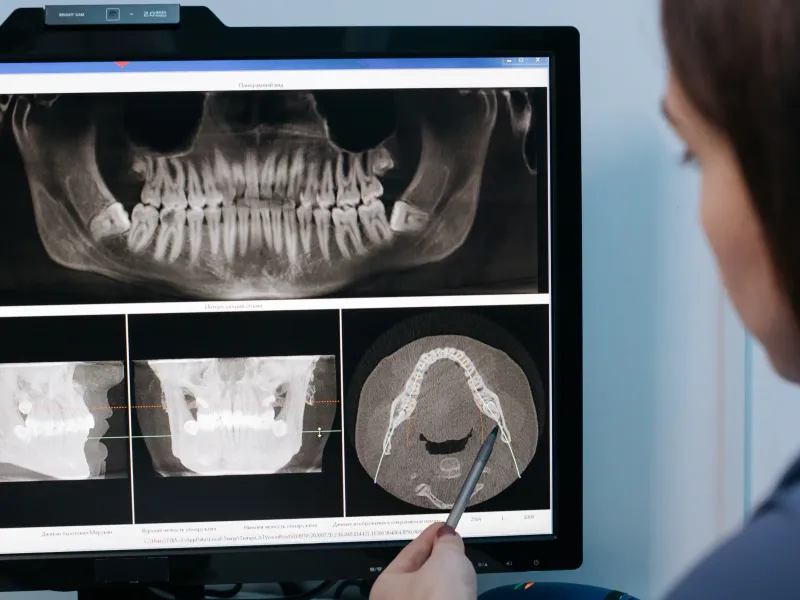 Oral Cancer Screening at 3D Dental in Mastic, NY