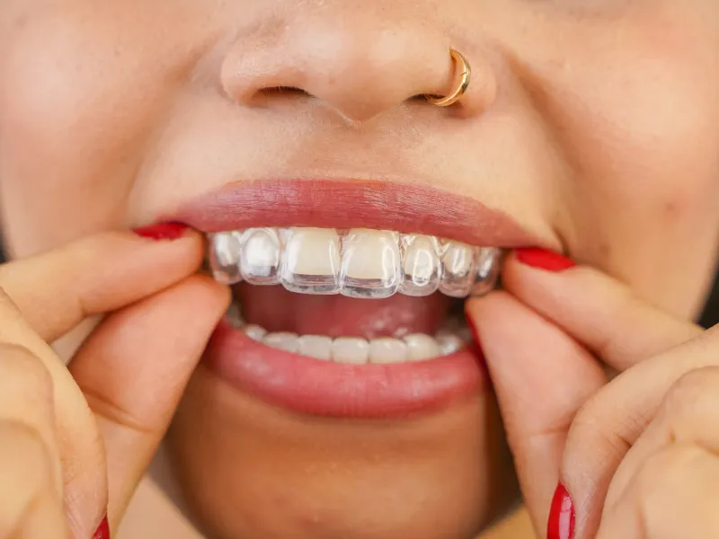 Invisalign at 3D Dental in Mastic, NY