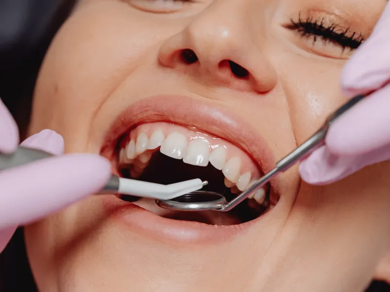 Soft Tissue Grafting at 3D Dental in Mastic, NY