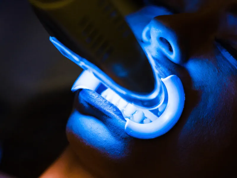 Zoom Whitening at 3D Dental in Mastic, NY